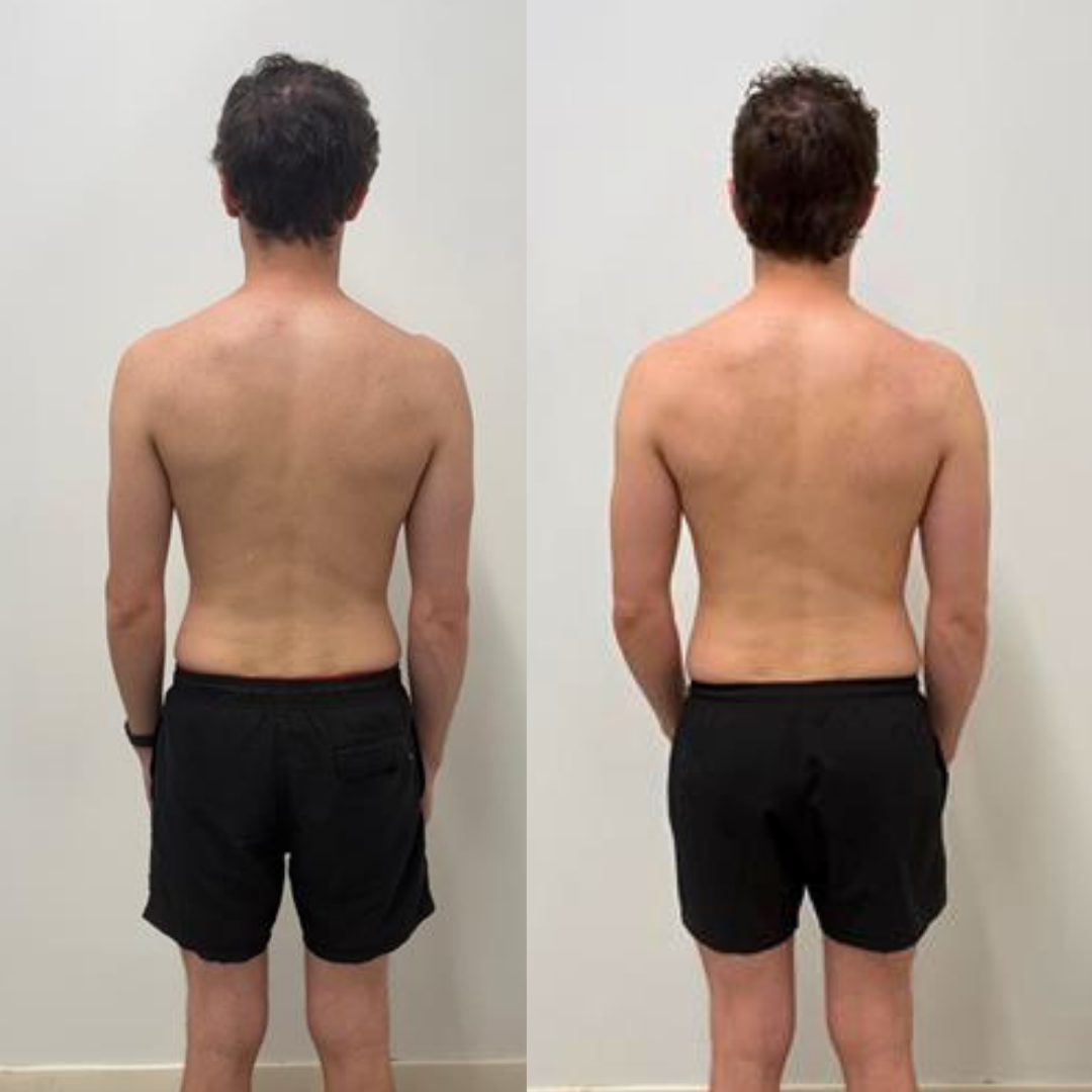 muscle building before and after