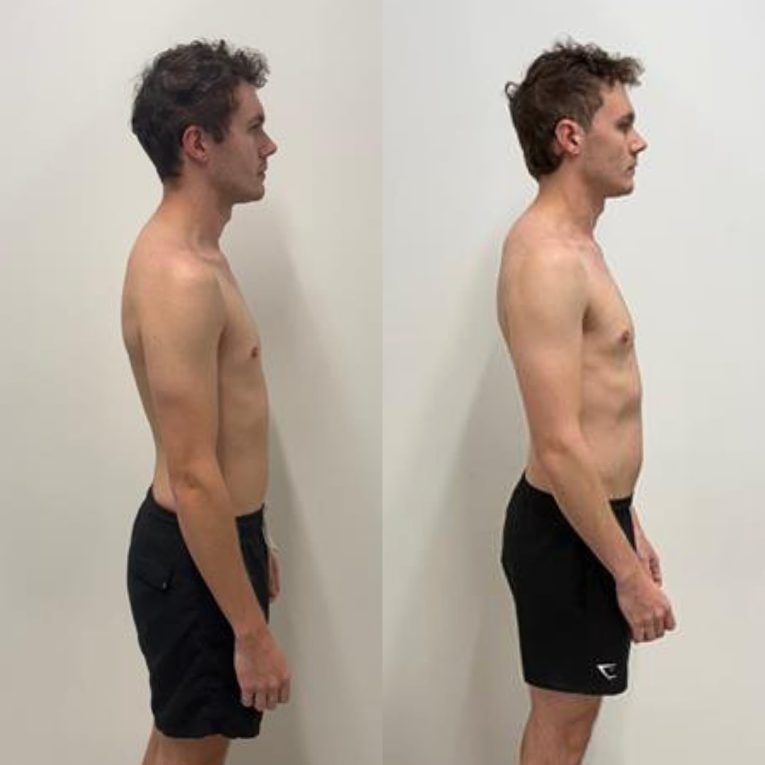 muscle building before and after
