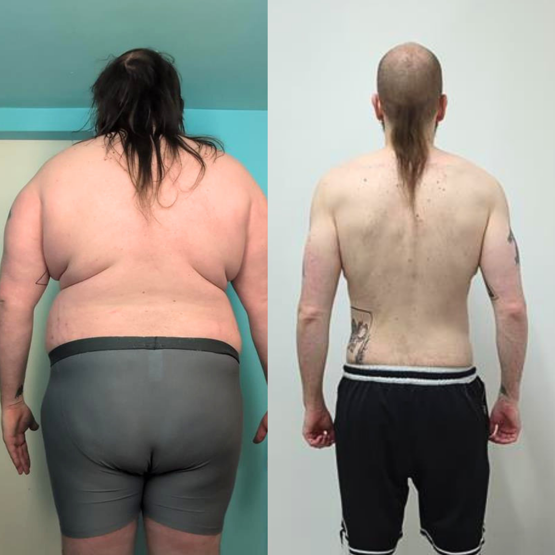 100lb weight loss 