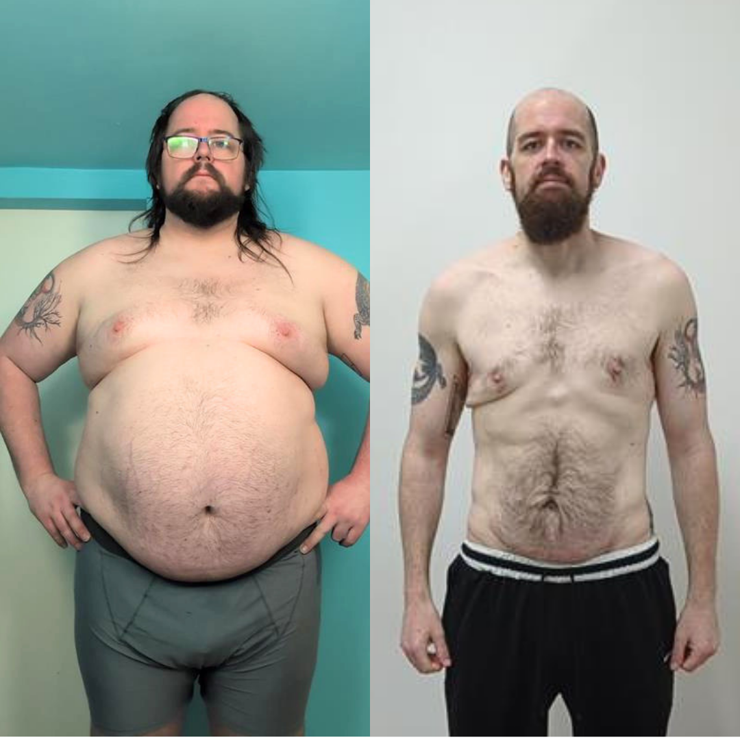 100lb weight loss 