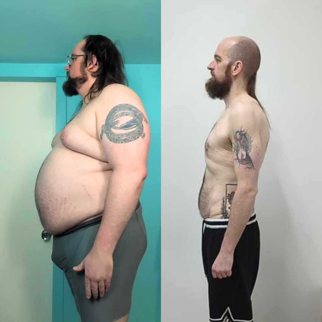 100lb weight loss 